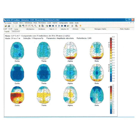 BNT-EEG-Exames